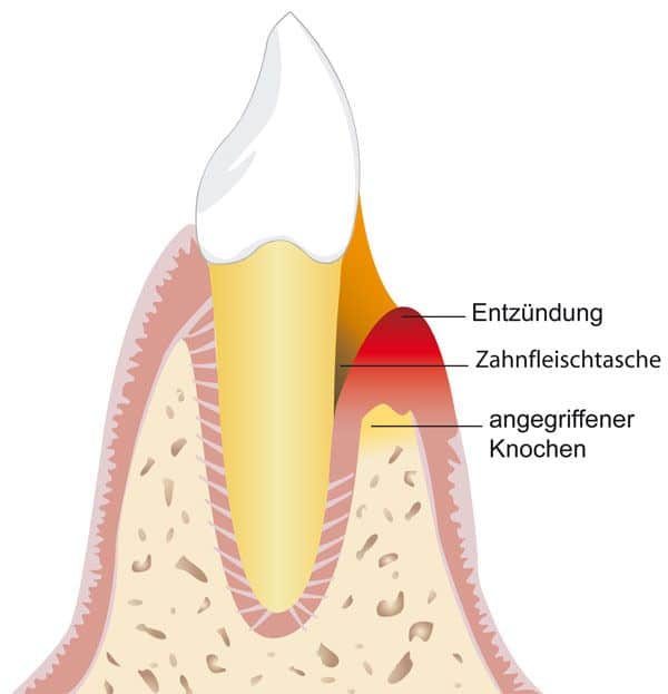 Anzeichen