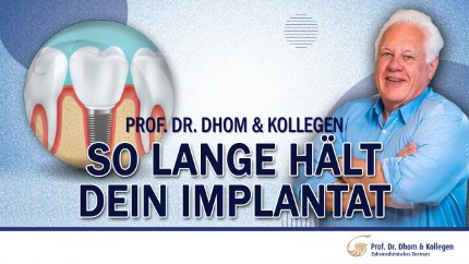 Wie lange hält ein Implantat?